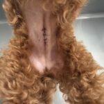 開腹手術の術創