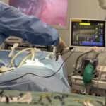 腹腔鏡ってどんな手術？