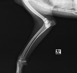 上腕骨骨折（遠位端）