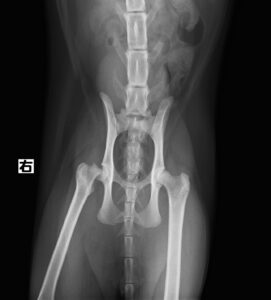 右大腿骨頭すべり症
