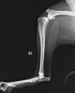 左側前十字靭帯断裂