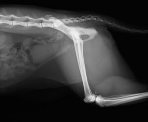 右大腿骨頭すべり症