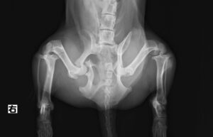 骨盤骨折