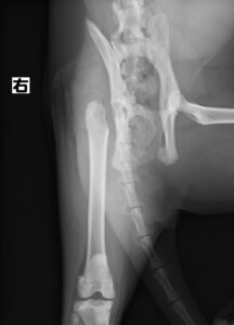 右大腿骨頭すべり症