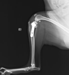 左側前十字靭帯断裂