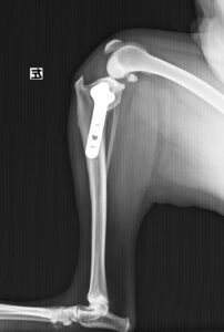 左側前十字靭帯断裂