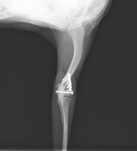 上腕骨骨折（遠位端）