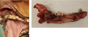 口腔内扁平上皮癌