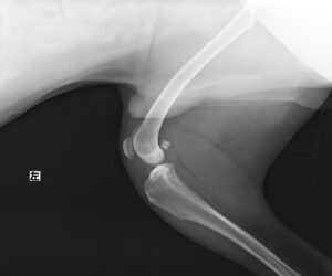 左側前十字靭帯断裂